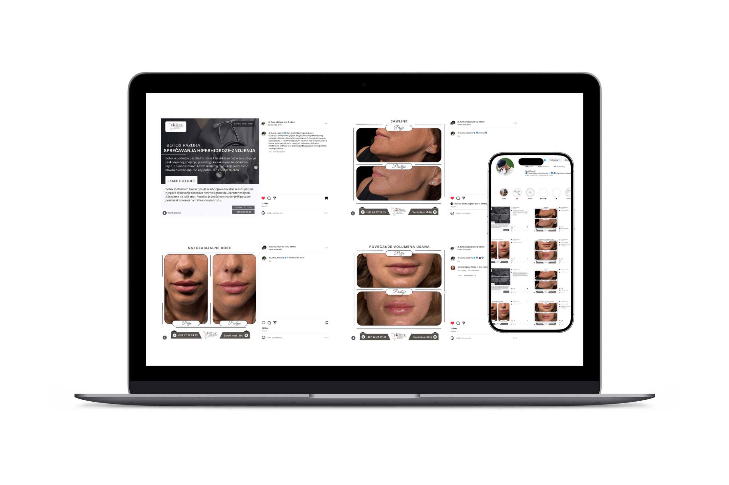 dr haris elezovic dr specijalista opste hirurgije u sanskom mostu digitalni marketing vlajkov odrzavanje profila na instagramu i savet za poboljsanje vidljivosti profila na tik toku